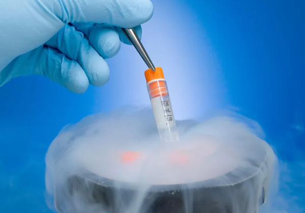 Egg freezing in Ahmedabad